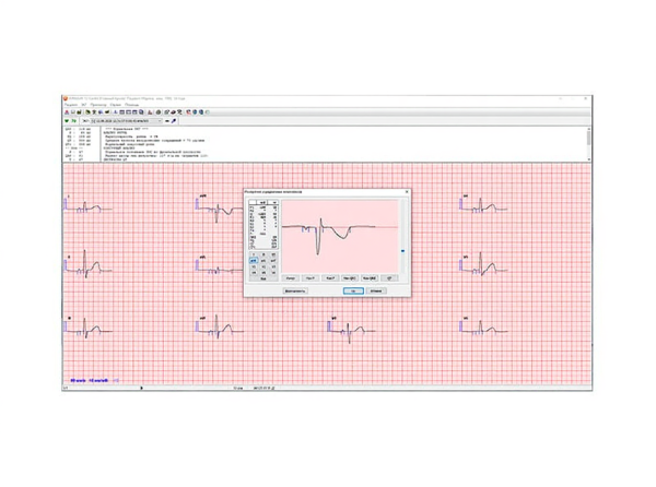 Кардиорегистратор КРП-01 с ПО ArMaSoft-12-Cardio