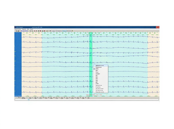 Монитор холтеровский ЭКГ КРН-01 (N1012) с ПО