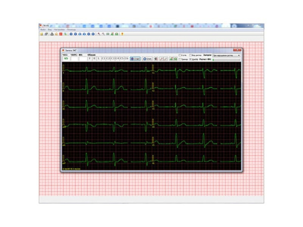 Кардиорегистратор КРП-01 с ПО ПК-01
